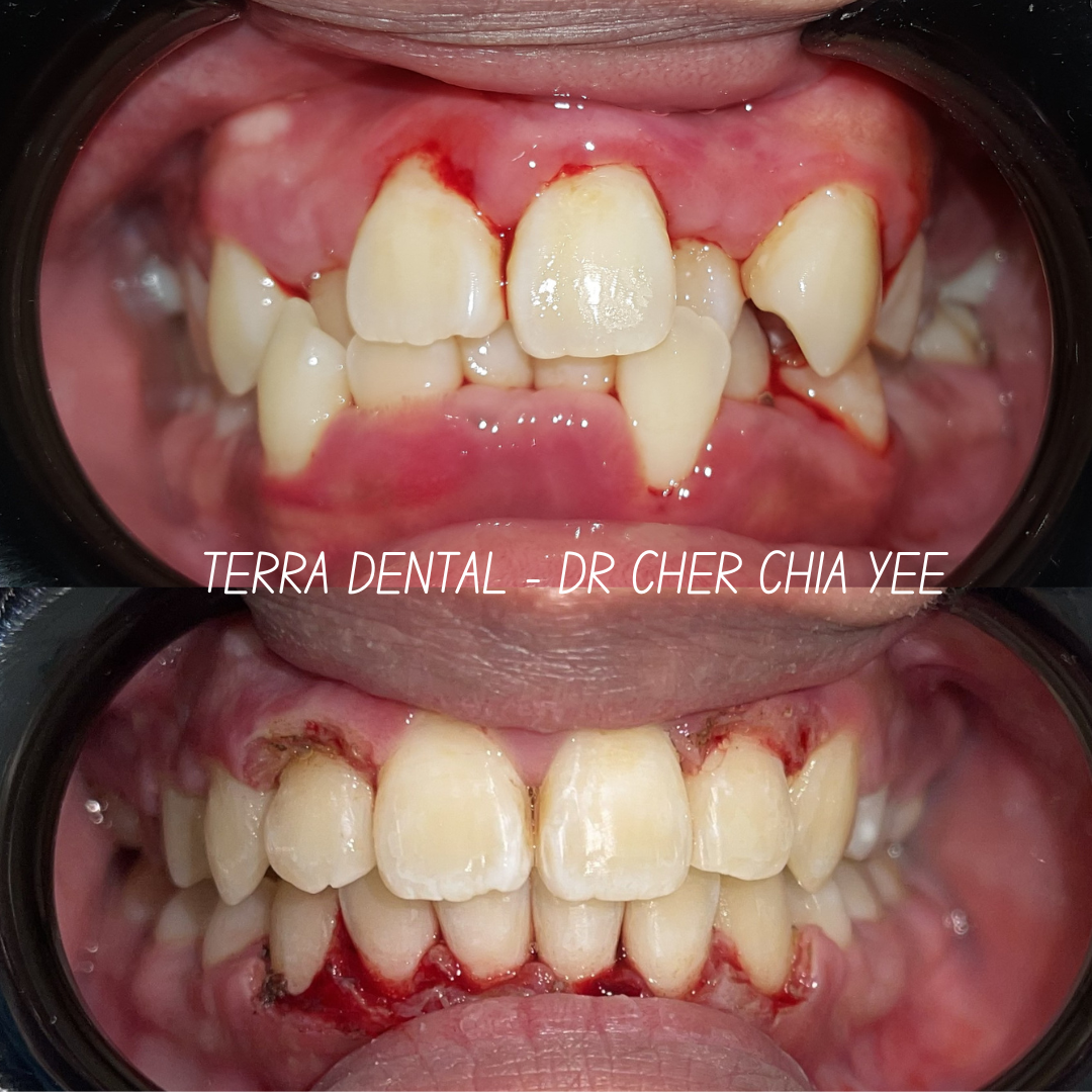 Smile transformation