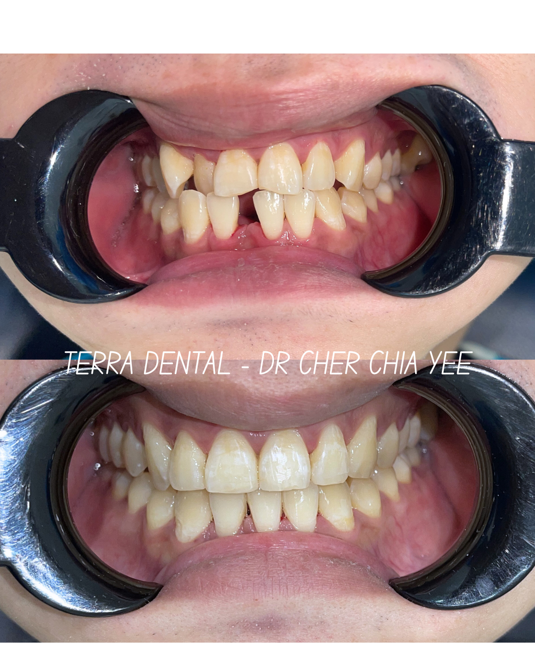 Smile transformation